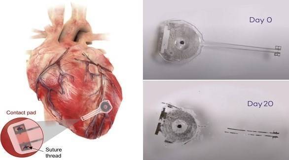 Scientists Develop First Wireless Pacemaker