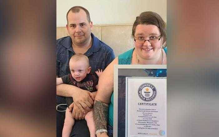 The World’s Youngest Survivor: Premature Baby Celebrates First Birthday