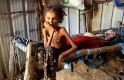 World Bank Grants Yemen $150 Million for Health, Food, and Water Services
