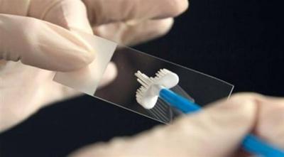 Symptoms Warning of Cervical Cancer
