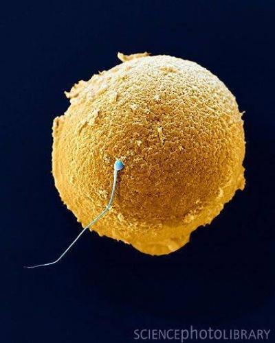 Scientists Discover How Sperm Move Toward the Egg