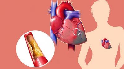 Snack Options to Lower Cholesterol in Days
