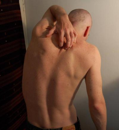 Itching is Also a Sign of Cancer