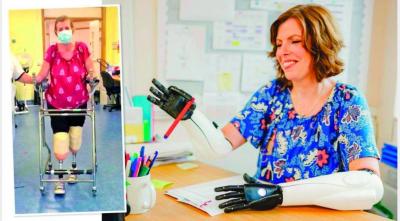 British Teacher Who Lost All Four Limbs Returns to Teaching
