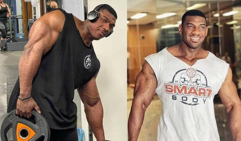 Revealing the Cause of Death of Saudi Bodybuilding Champion Fahd Hazzazi