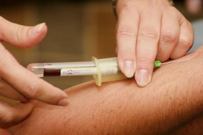 ## Self-Blood Therapy for Immune Activation and General Health Improvement