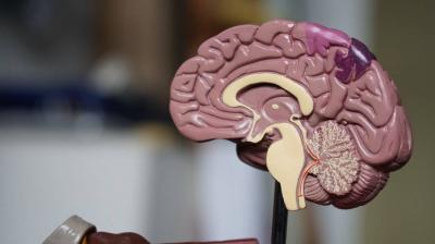 Vitamin Deficiency Causes Stroke