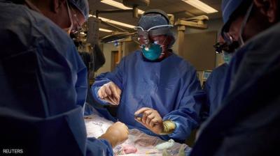 In a Rare Case... Pig Kidney Transplanted into an American Woman