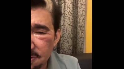 Video: Saudi Artist Abdullah Al-Sadhan Suffers Severe Facial Injury