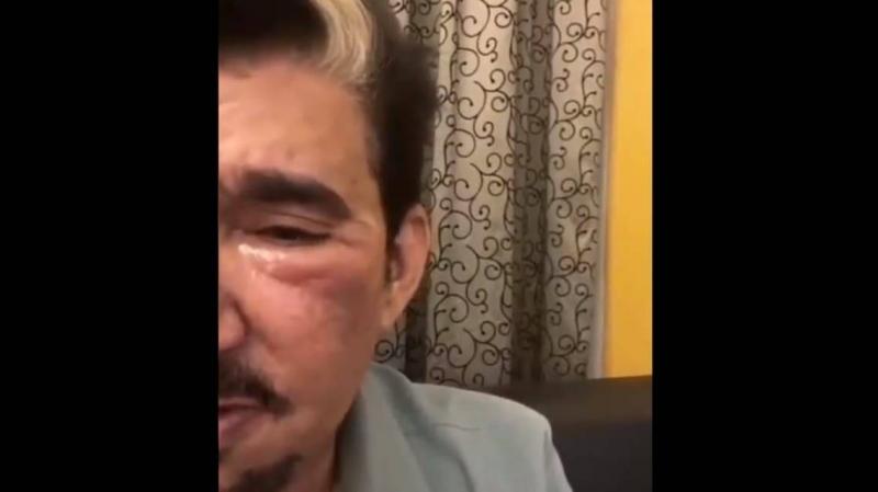 Video: Saudi Artist Abdullah Al-Sadhan Suffers Severe Facial Injury