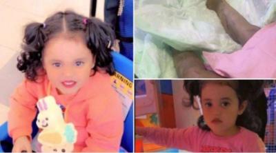 Shocking Crime in Jeddah: Pouring Acid on His Wife and Daughter