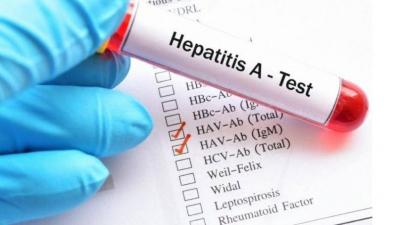 Title: Shocking Toll of Viral Hepatitis in Lebanon