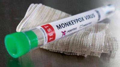 Monkeypox Causes Vision Loss!?
