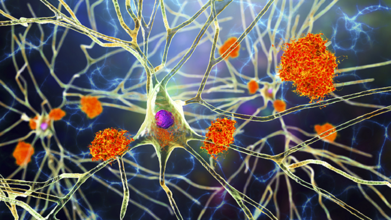 Title: Scientists Identify Vitamin Linked to Brain Decline