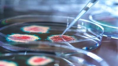 Is Egypt at Risk of the Deadly "Rhabdos" Disease?