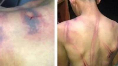 Continued Violence Incidents: The Whipping of His Minor Son