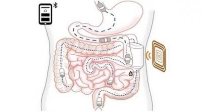 Robot for Swallowing to Deliver Insulin in the Body