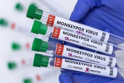 First Case of Monkeypox in Lebanon