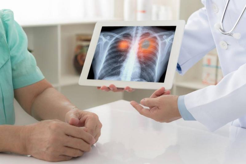 When Coughing Becomes an Early Sign of Lung Cancer...