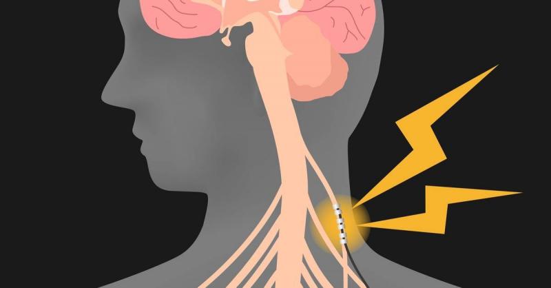 The Importance of the Vagus Nerve and How to Stimulate It