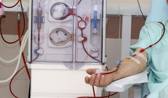 What Fate Awaits Kidney Dialysis Patients?