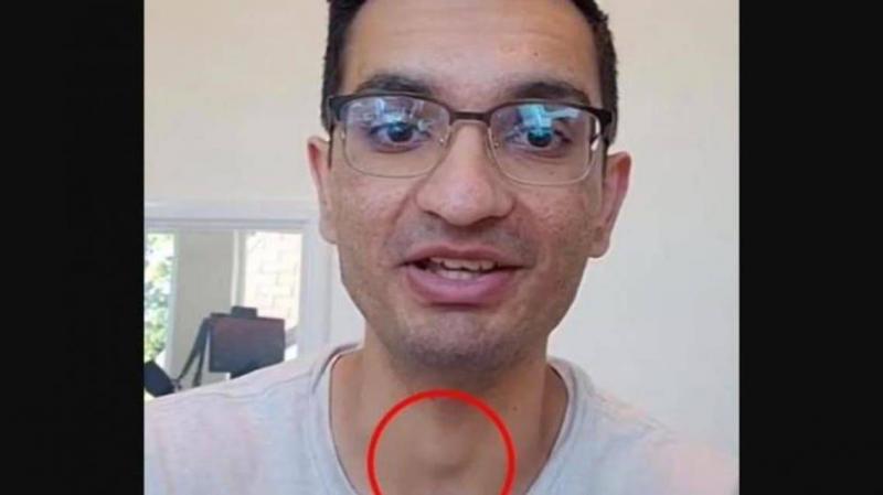 Shock on TikTok: He Discovered His Cancer Diagnosis from a Scene