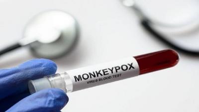 Who Needs Vaccination Against Monkeypox?