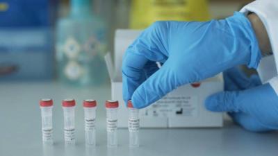 First Case of COVID-19 Transmission from Cat to Human in Thailand