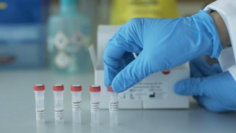 First Case of COVID-19 Transmission from Cat to Human in Thailand