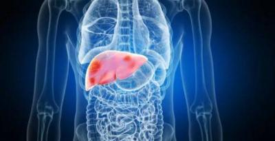 Important Warning: Signs of Liver Disease You Should Not Ignore