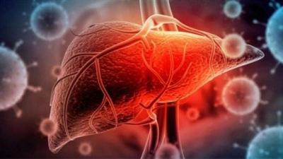 650 Possible Hepatitis Cases Among Children Worldwide