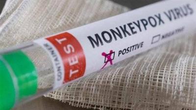 Should We Fear "Monkeypox"?