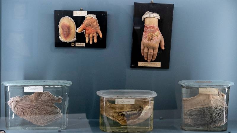 متحف يثير الرعب في فيينا.. جماجم وأحشاء بشرية