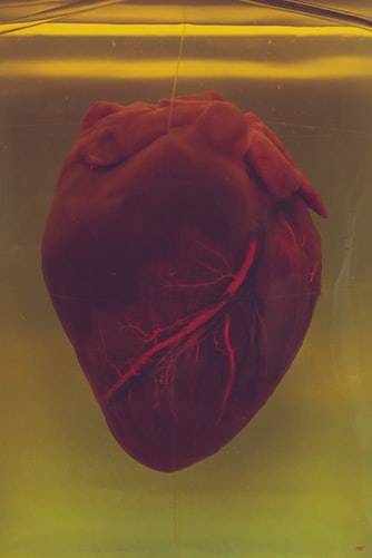 سبب غريب لأمراض القلب والأوعية الدموية