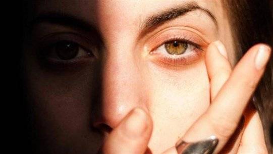 Sunburns Can Affect the Eye