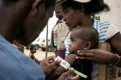 Severe Malnutrition Threatens Over Half a Million Children in Madagascar