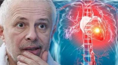Hidden Warning Sign on Your Lips Indicating a Heart Attack