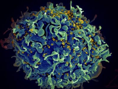 Preliminary Study: Cancer Treatment Might Target HIV
