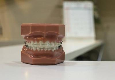 The Truth About an Iraqi Dentist Extracting Her Cheating Husband's Teeth