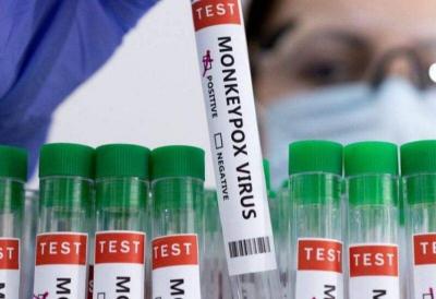 WHO: Monkeypox Is Not a Global Health Emergency