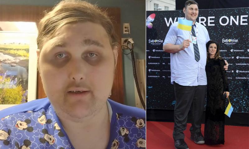 Death of the Tallest Man in the United States at 38 Years Old