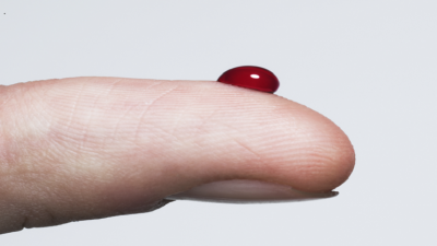 Five Vegetables That Can Rapidly Raise Blood Sugar Levels!