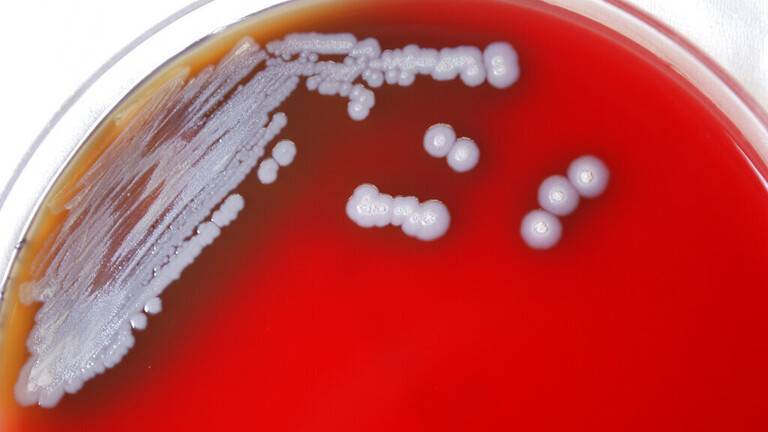 American Centers for Disease Control Announce Discovery of Deadly Bacteria in the Country