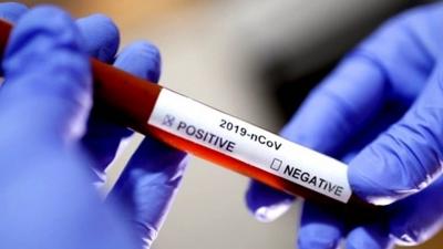 The Ideal Number of COVID Vaccine Doses for Optimal Protection Revealed by Scientists