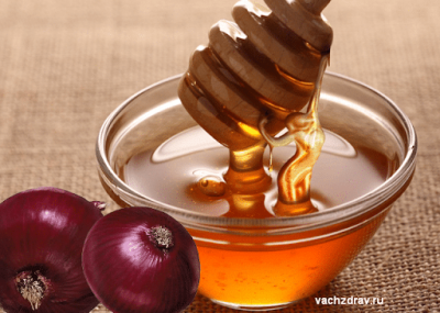 Fighting the Cold Season with Onion and Honey Treatment