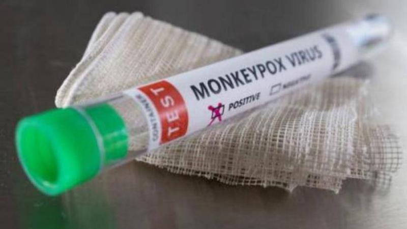 New Complication of Monkeypox Threatens the Heart