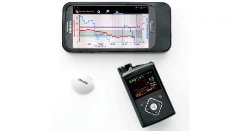Artificial Pancreas Changes Lives of Diabetic Children