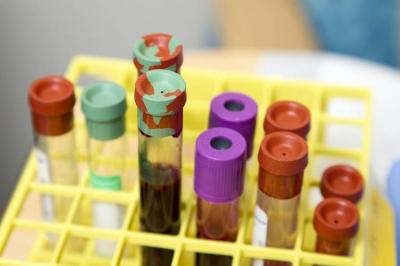 New Drug Reduces Risk of Blood Clots After Surgery
