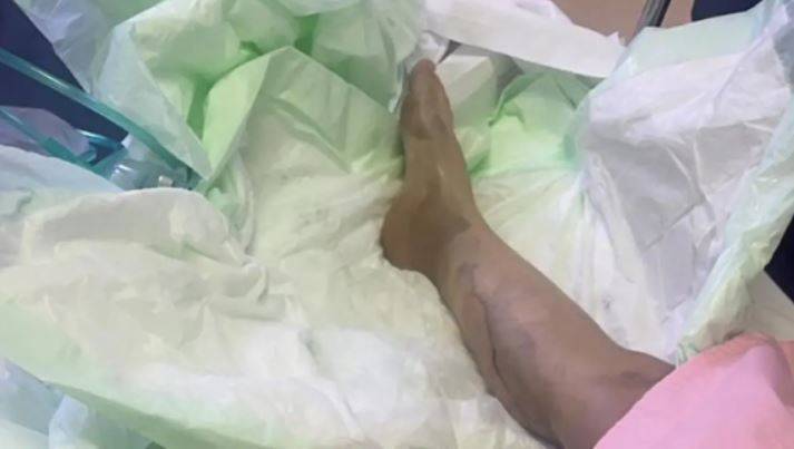 Horrific Details About a Woman Set on Fire with Acid in Jeddah... and Her Last Wish