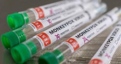 How the Monkeypox Outbreak Differs from Previous Cases